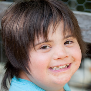 Closeup portrait of young girl with Down Syndrome